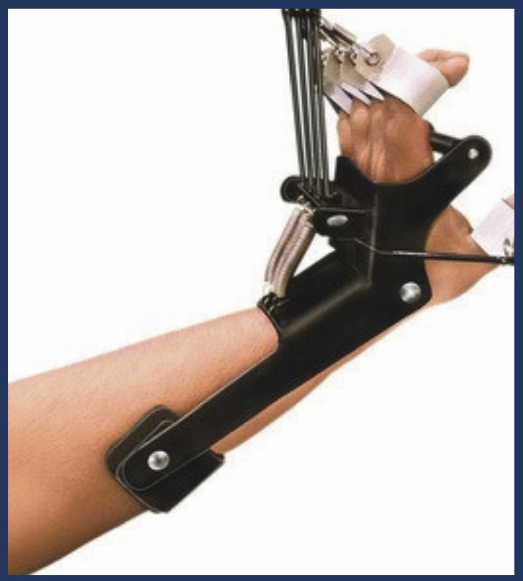 Dynamic Cock-Up with Finger Extension — Scanda Enterprises, medical supplies Moosapet Hyderabad